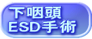 下咽頭 ESD手術